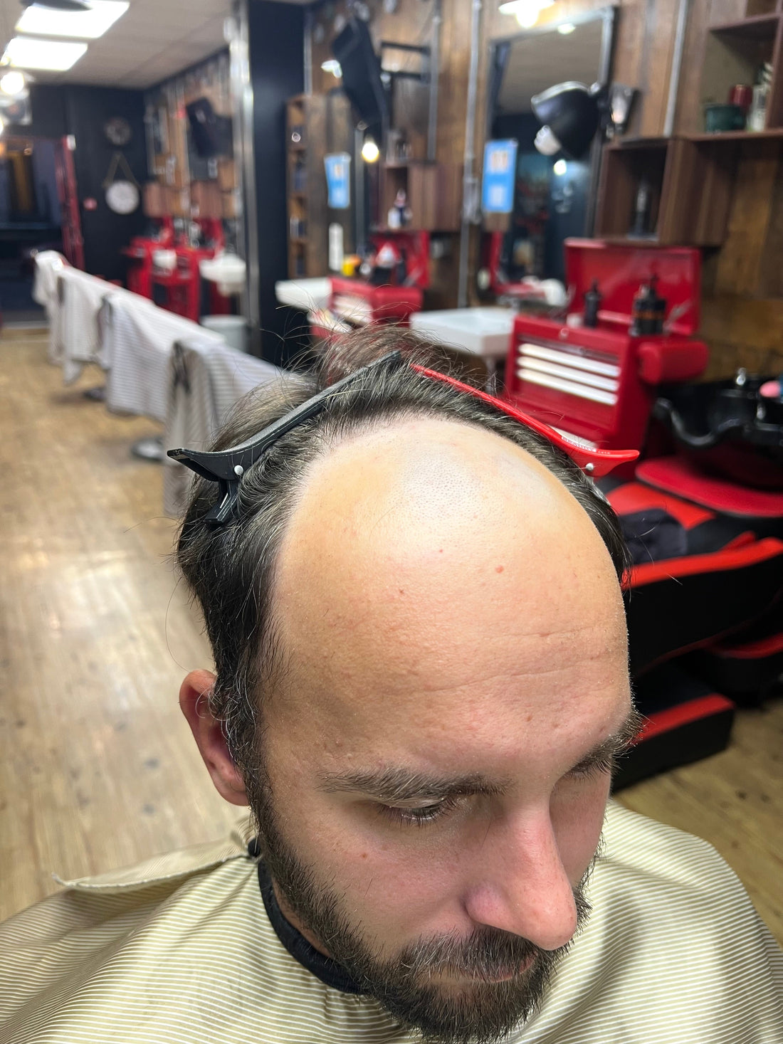 Private Home Hair System Consultation for Men in Gloucestershire - Pro Hair Edit