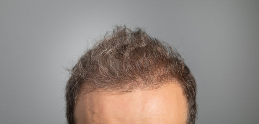 Top 3 Signs It's Time to Consider a Non-Surgical Hair System - Pro Hair Edit