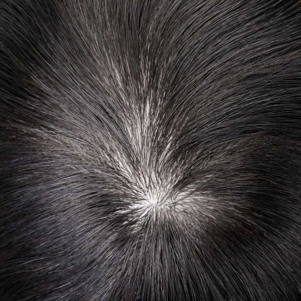 PHE - INL Poly Hair System Injected Skin Base With Diamond Lace - Pro Hair Edit